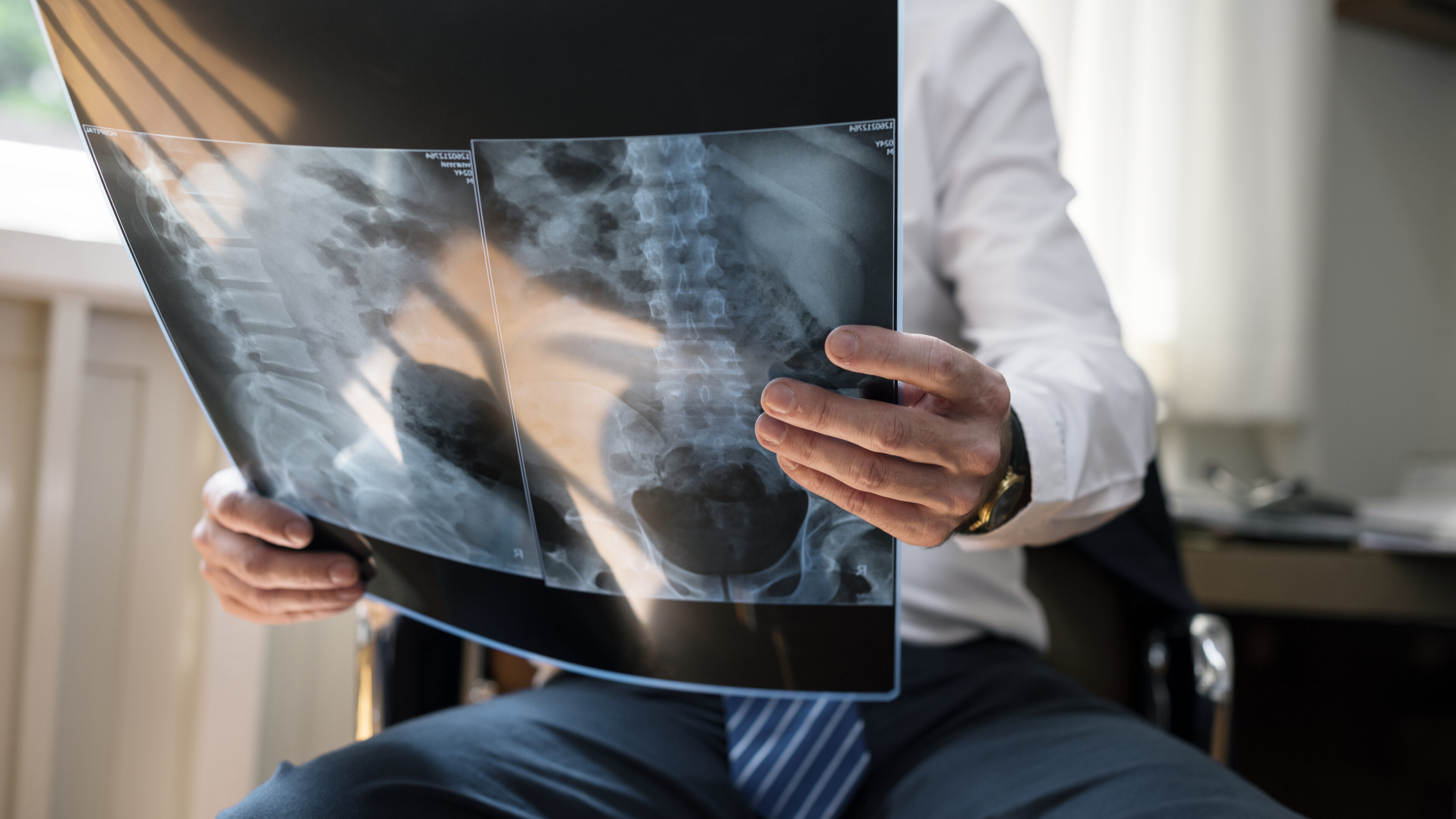 Doctor checking patient's x-ray result