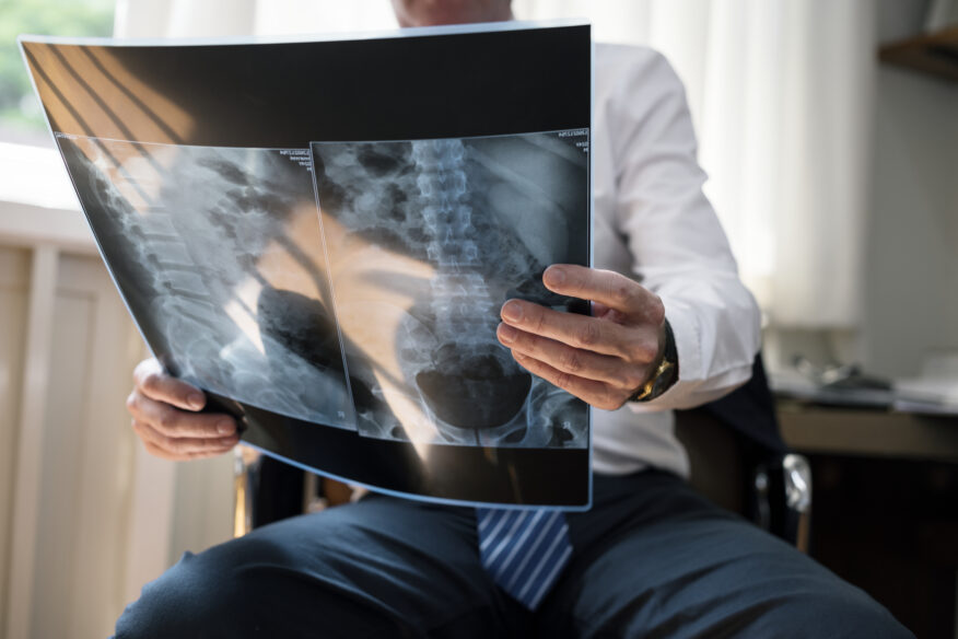 image of coal miner to represent workers compensation medical expenses coal miners